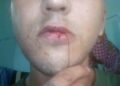 Florencio Varela: Un preso se cosió los párpados y los labios en señal de protesta