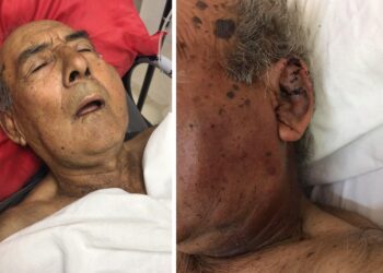 Cañada de Gómez: Jubilado de 79 años fue golpeado hasta quebrarle la mandíbula, el pómulo, la dentadura y terminó hospitalizado