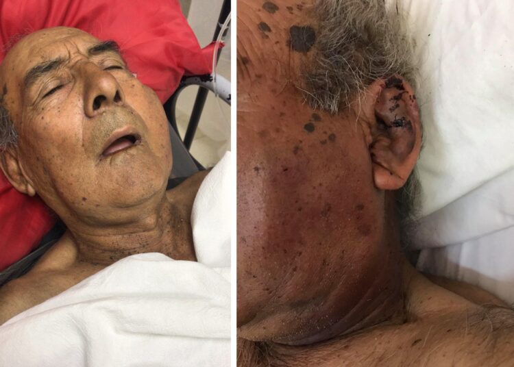 Cañada de Gómez: Jubilado de 79 años fue golpeado hasta quebrarle la mandíbula, el pómulo, la dentadura y terminó hospitalizado