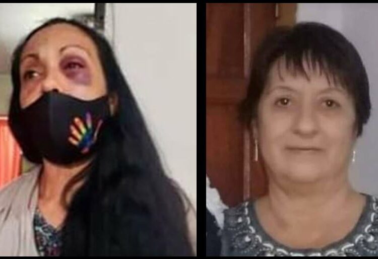 Córdoba: Asesinan a una mujer a golpes por quejarse del alto volumen de la música