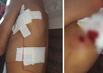 Totoras: un hombre resultó apuñalado en medio de una gresca